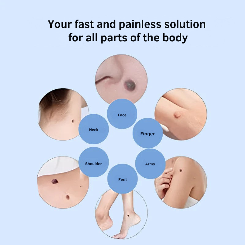 DermaPen™ | Bye Bye Skin Tags