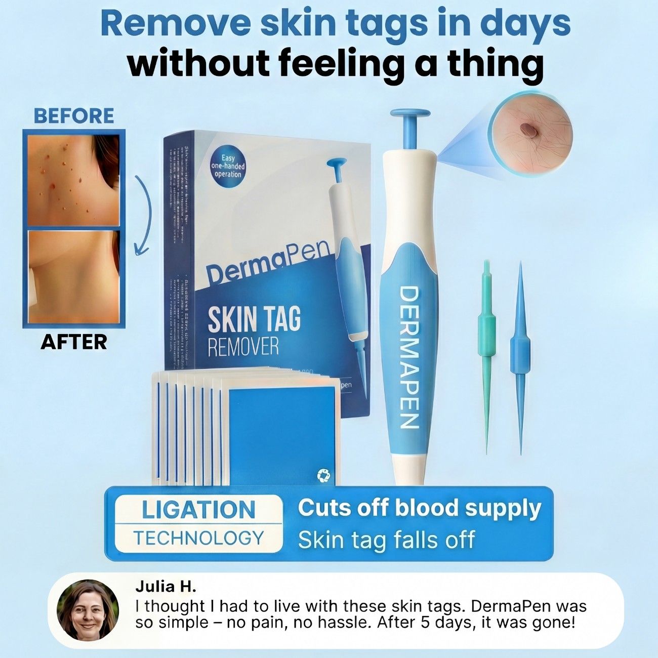 DermaPen™ | Bye Bye Skin Tags
