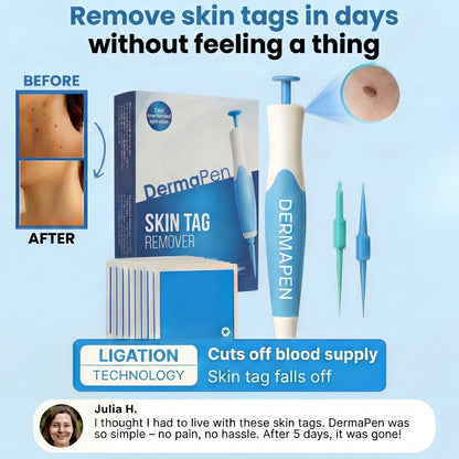DermaPen™ | Bye Bye Skin Tags