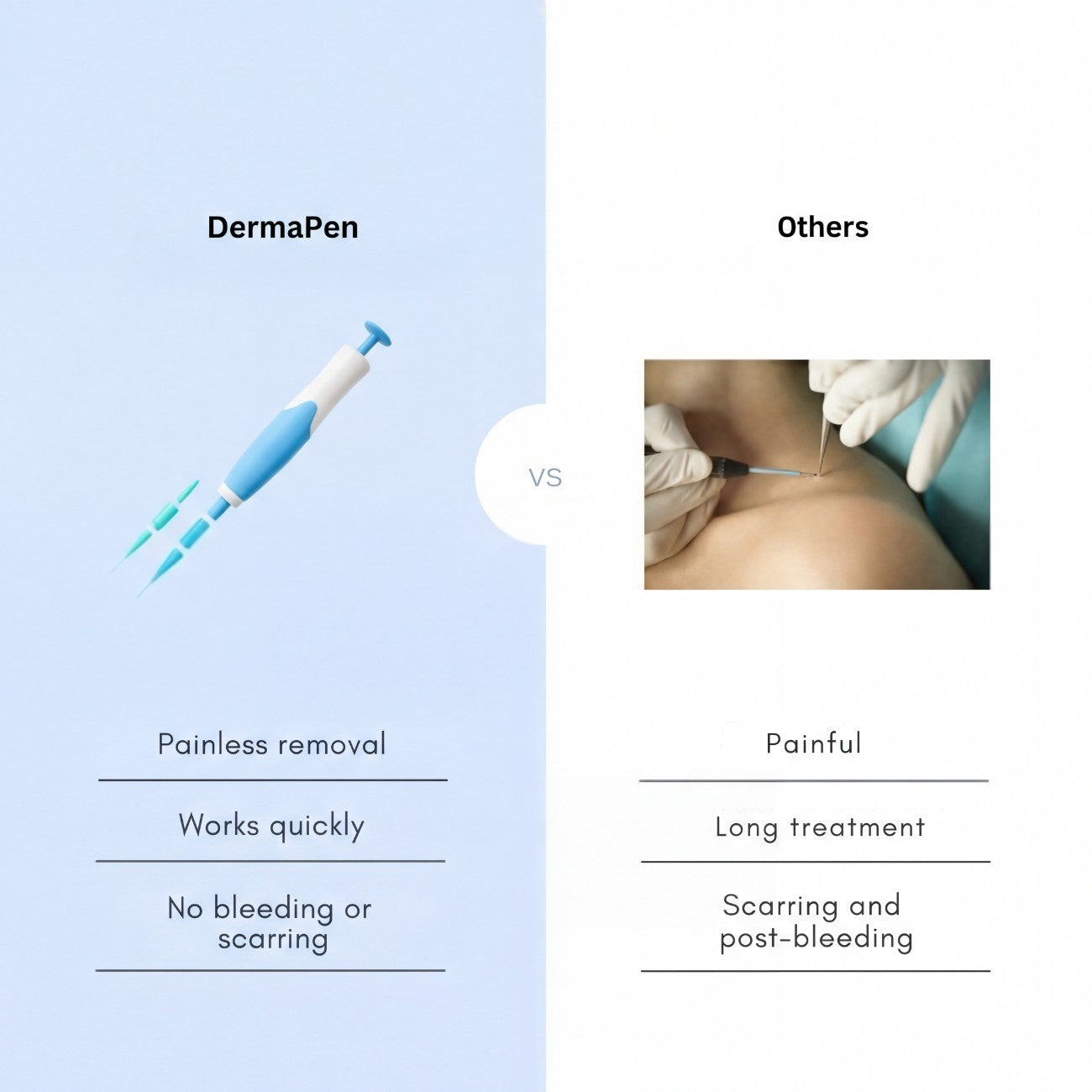 DermaPen™ | Bye Bye Skin Tags